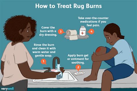 treating a rug burn